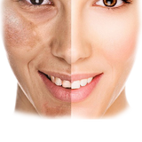 Pigmentation/Melasma Treatment Plan (12 months)