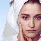 Acne Treatment Plan 1 (12 months)