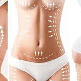 HIFU Body