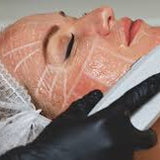 HIFU Training $3,500.00