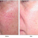 Vascular Treatment Plan (6 months)