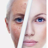 Clear Complexion Night Cream