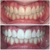 Crystal White Teeth Whitening