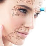 Plasma Fibroblasting Training $2,500.00
