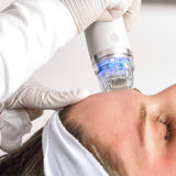 Fractional Radiofrequency Training $1,950.00