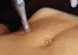 Advanced Dermal Facials