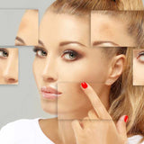 Medi Aesthetic Dermal Peels
