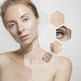 Laser Pigmentation