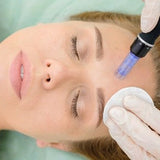 Skin Needling Training 2 Days Practical $1,995.00